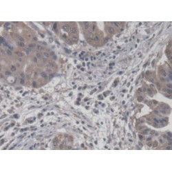 Carnitine-O-Octanoyltransferase (CORT) Antibody