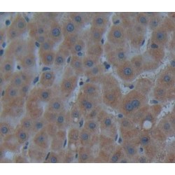 Carnitine-O-Octanoyltransferase (CORT) Antibody