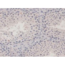 G-Elongation Factor, Mitochondrial 1 (GFM1) Antibody