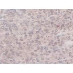 G-Elongation Factor, Mitochondrial 1 (GFM1) Antibody