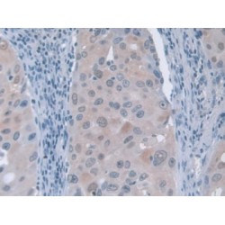 G-Elongation Factor, Mitochondrial 1 (GFM1) Antibody