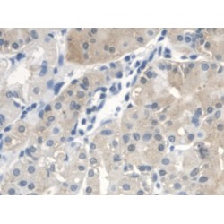 Di-N-Acetyl Chitobiase (CTBS) Antibody