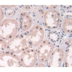 Xeroderma Pigmentosum, Complementation Group D (XPD) Antibody
