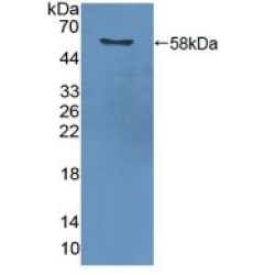 Proliferating Cell Nuclear Antigen (PCNA) Antibody