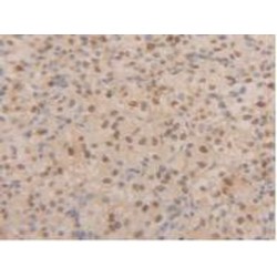 Proliferating Cell Nuclear Antigen (PCNA) Antibody