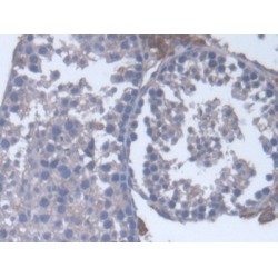 17-Alpha-Hydroxylase (S17aH) Antibody