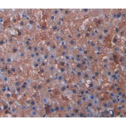 17-Alpha-Hydroxylase (S17aH) Antibody