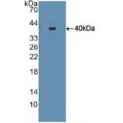 17-Alpha-Hydroxylase (S17aH) Antibody