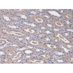 Radixin (RDX) Antibody