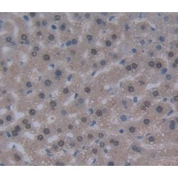 Dyskerin (DKC) Antibody
