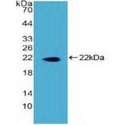 Dyskerin (DKC) Antibody