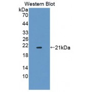 Western blot analysis of recombinant Dystrophia Myotonica Protein Kinase using Dystrophia Myotonica Protein Kinase (DMPK) Antibody.