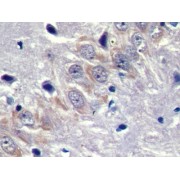 IHC-P analysis of Rat Cerebrum Tissue, using Dystrophia Myotonica Protein Kinase (DMPK) Antibody (10 µg/ml) followed by HRP-conjugated Goat Anti-Rabbit antibody (<a href="https://www.abbexa.com/index.php?route=product/search&amp;search=abx400043" target="_blank">abx400043</a>, 2 µg/ml).