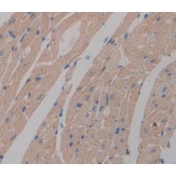 5',3'-Nucleotidase, Cytosolic (NT5C) Antibody