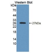 Western blot analysis of the recombinant protein.