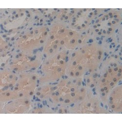 Cyclin Dependent Kinase 2 Associated Protein 1 (CDK2AP1) Antibody