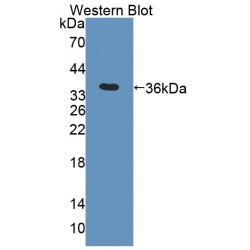 3-Ketoacyl-CoA Thiolase, Mitochondrial (ACAA2) Antibody