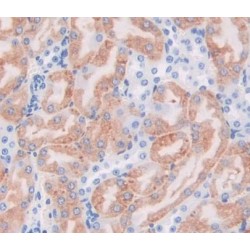 3-Ketoacyl-CoA Thiolase, Mitochondrial (ACAA2) Antibody