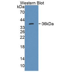 3-Ketoacyl-CoA Thiolase, Mitochondrial (ACAA2) Antibody