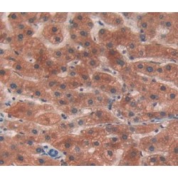 3-Ketoacyl-CoA Thiolase, Mitochondrial (ACAA2) Antibody