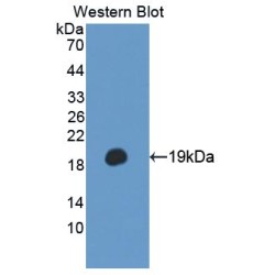 Delta Sleep-Inducing Peptide (dSIP) Antibody