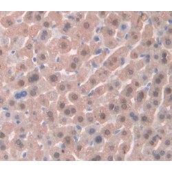 Delta Sleep-Inducing Peptide (dSIP) Antibody