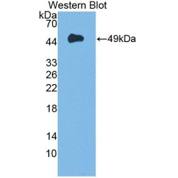 Dystroglycan (DAG1) Antibody
