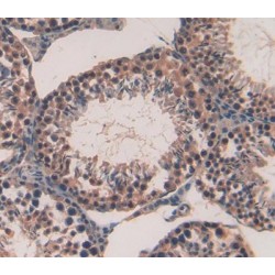 Pituitary Tumor Transforming 1 (PTTG1) Antibody