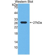 Western blot analysis of the recombinant protein.