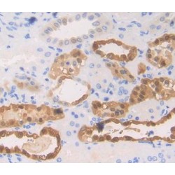 Erythrocyte Membrane Protein Band 4.1 (EPB41) Antibody