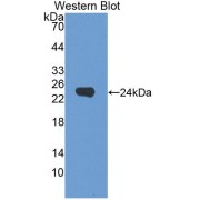 Western blot analysis of the recombinant protein.