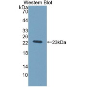 abx130998