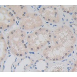 Fibrillarin (FBL) Antibody