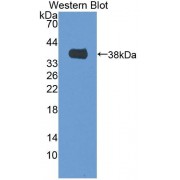 Western blot analysis of the recombinant Mouse MTFMT protein.
