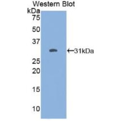 Forkhead Box Protein O1 (FOXO1) Antibody