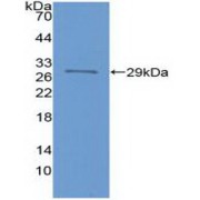 Western blot analysis of recombinant Human FOXP3.