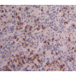 Forkhead Box Protein P3 (FOXP3) Antibody