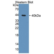 Western blot analysis of the recombinant protein.