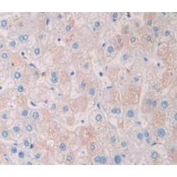 GDP-L-Fucose Synthetase (GFUS) Antibody