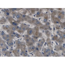 Gamma-Aminobutyric Acid B Receptor 1 (gABBR1) Antibody