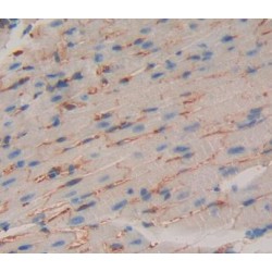 Gamma-Aminobutyric Acid B Receptor 1 (gABBR1) Antibody