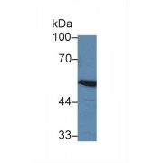 Western blot analysis of Rat Cerebrum lysate, using Human ABAT Antibody (3 µg/ml) and HRP-conjugated Goat Anti-Rabbit antibody (<a href="https://www.abbexa.com/index.php?route=product/search&amp;search=abx400043" target="_blank">abx400043</a>, 0.2 µg/ml).