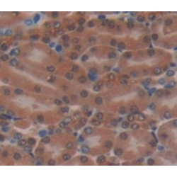 Myotrophin (MTPN) Antibody