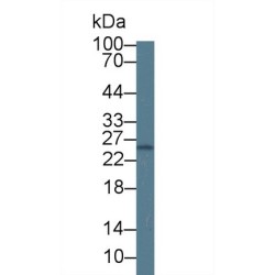 Grancalcin (GCA) Antibody