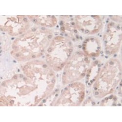 Grancalcin (GCA) Antibody