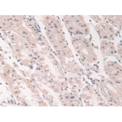 Grancalcin (GCA) Antibody