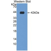 Western blot analysis of the recombinant protein.