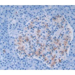 Glutamine Fructose-6-Phosphate Transaminase 1 (GFPT1) Antibody