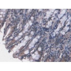 Fucose-1-Phosphate Guanylyltransferase (FPGT) Antibody