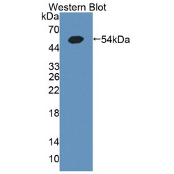Hexokinase-4 (GCK) Antibody